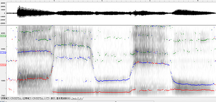 図3 音響分析により声を視覚化した様子