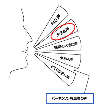 図12 パーキンソン病患者さんの声の大きさ（青枠）